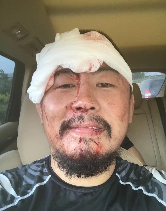格斗狂人受够了!徐晓冬被打伤后出面痛斥网络流言蜚语!